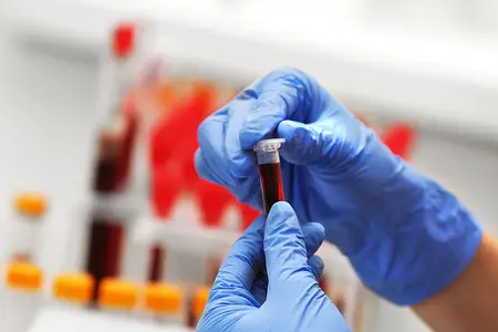 БАБИО лансира флуоресцентни брзи тест на трудноћу говеда